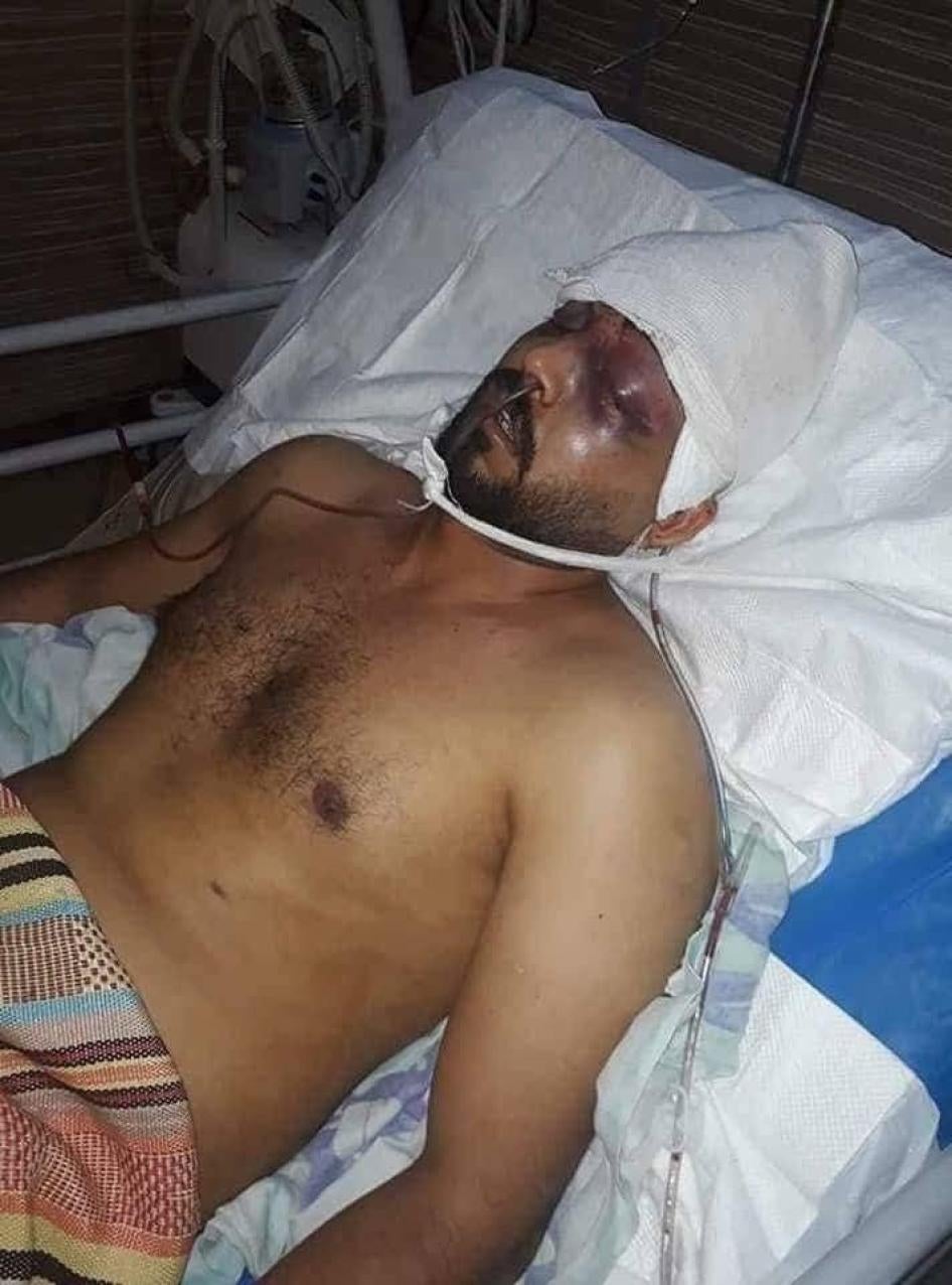 Witnesses said that Muhammad Abd Ali Naim, 24, suffered head wounds inflicted by Iraqi security forces while protesting in front of the Basra Governorate office on July 15, 2018. As of July 23, 2018, he was still in a coma. © 2018 Private 