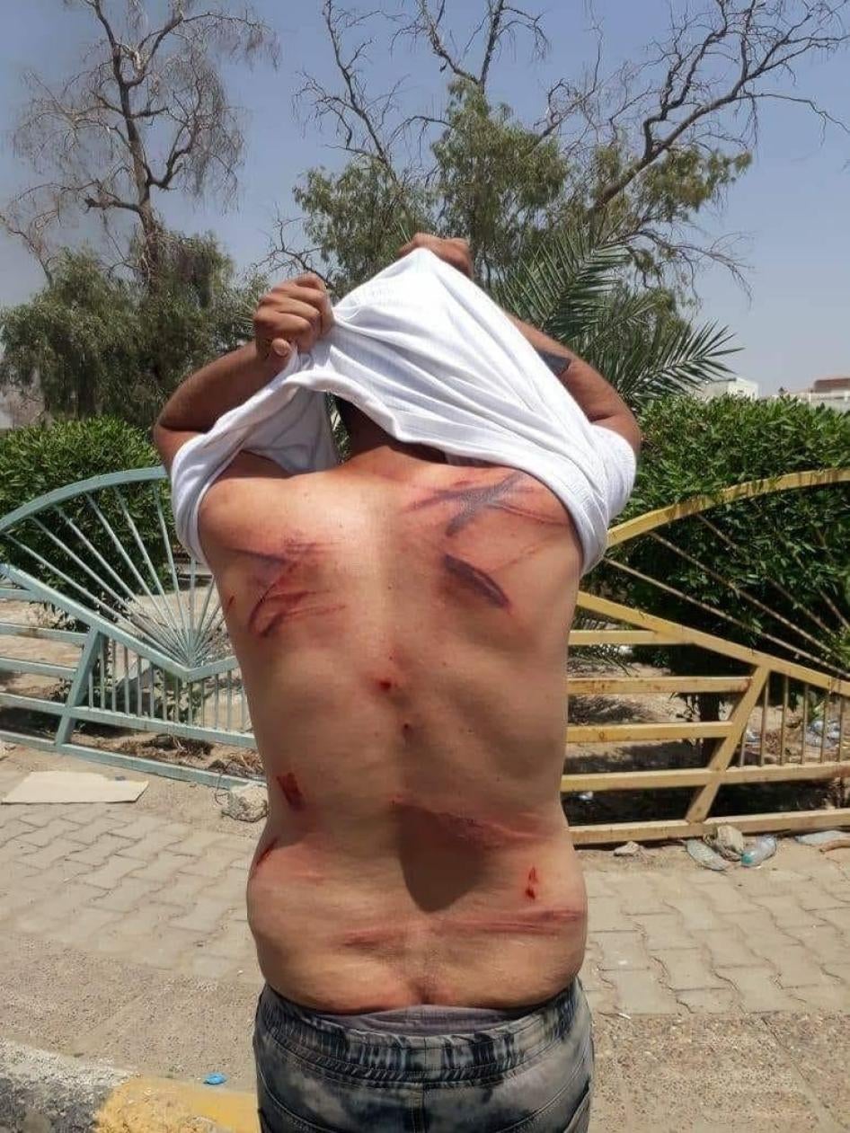 The injured back of a man who attended the July 15 protest outside the Basra Governorate office. He said anti-riot police detained and repeatedly beat him with metal pipes and plastic cables. © 2018 Private