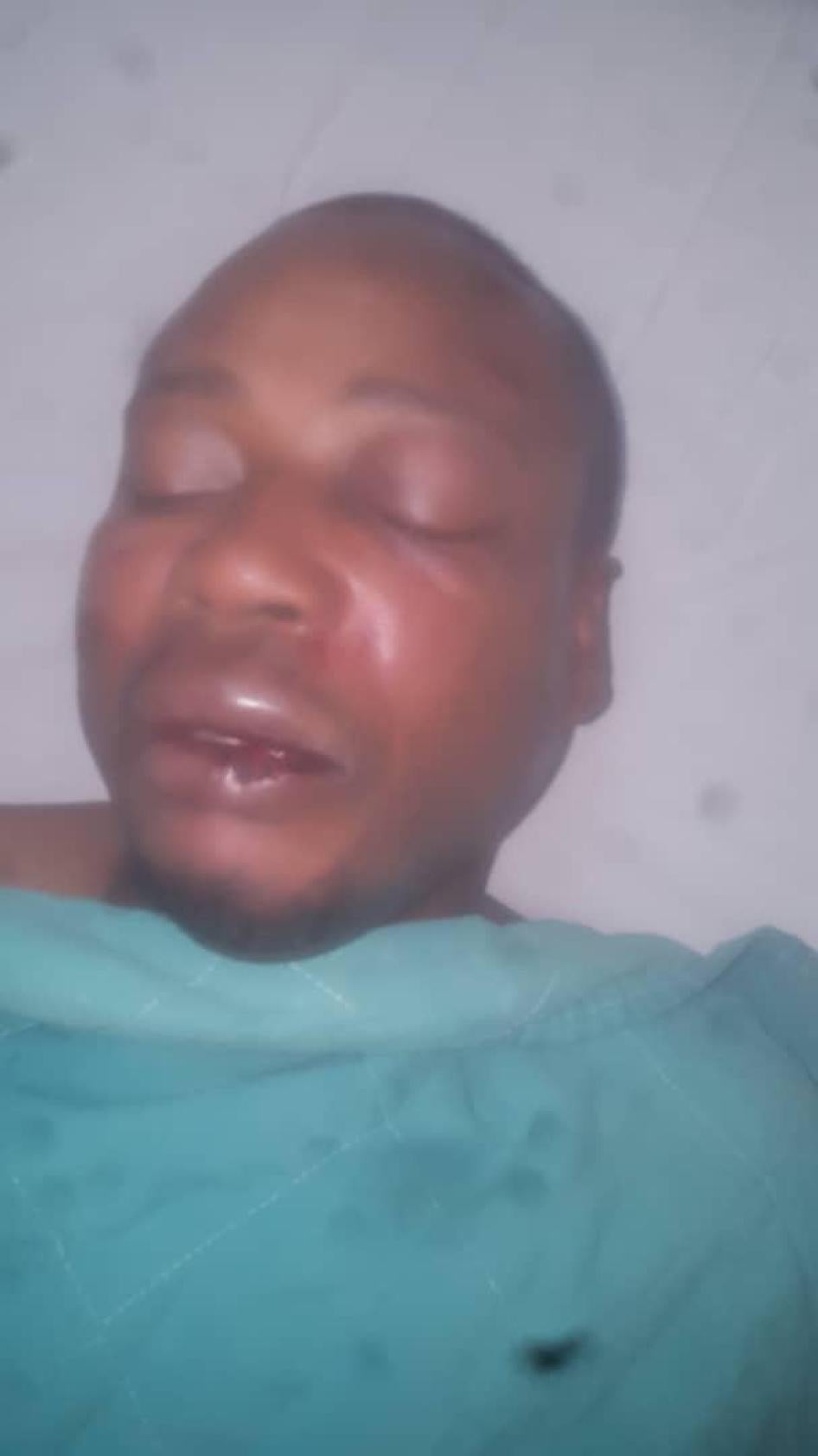 L'activiste équato-guinéen Alfredo Okenve, photographié peu après l'agression qu'il a subie le 27 octobre 2018.