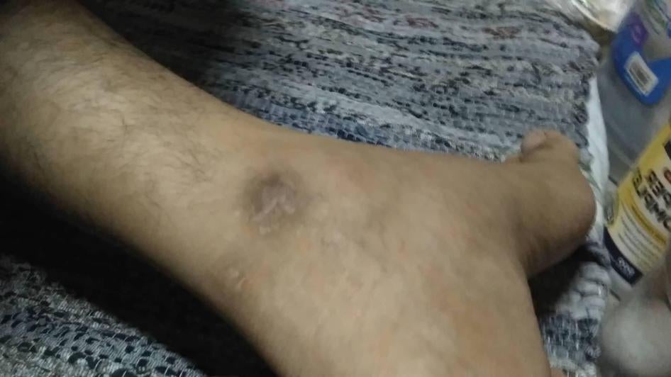 حصلت هيومن رايتس ووتش على صور وفيديو صُّورت مؤخرا لجروح حسن. قال خبراء إن الجروح تتسق مع شهادة حسن عن الانتهاكات.