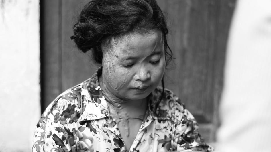 مونغ سريموم، ضحية هجوم بالأسيد في بنوم بن، كمبوديا، 19 نوفمبر/تشرين الثاني 2014.