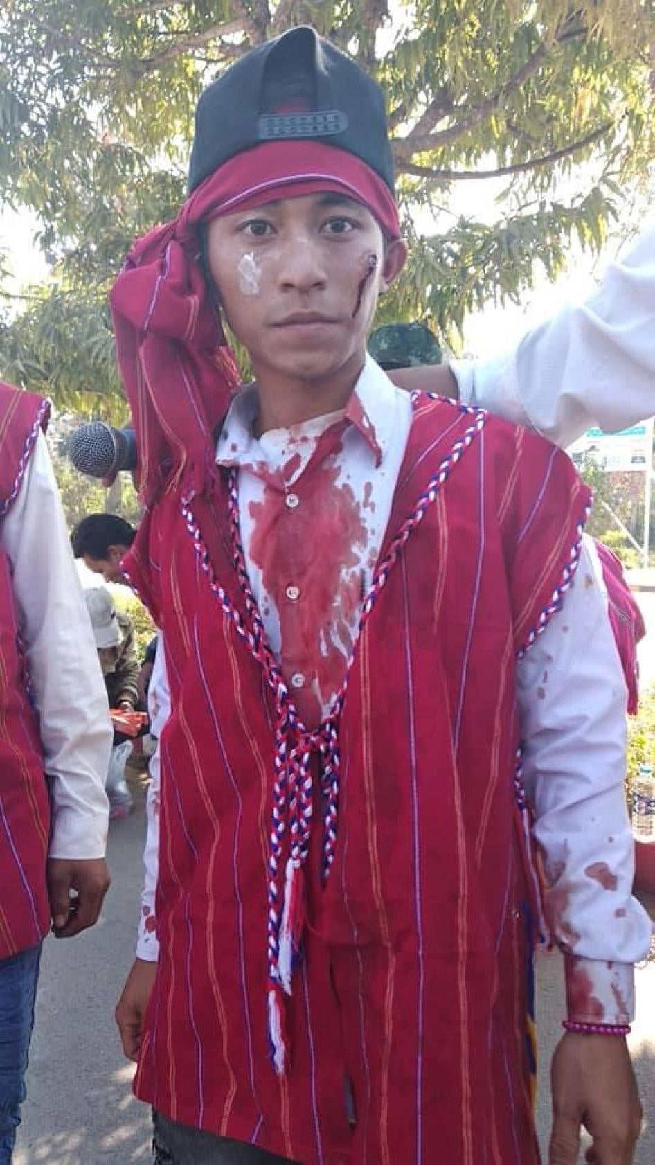 A youth stands bloodied after police violently disperse Karenni protesters in Karenni State on February 12, 2019. 