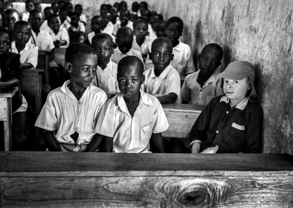 A boy with albinism seats in a classroom with other pupils