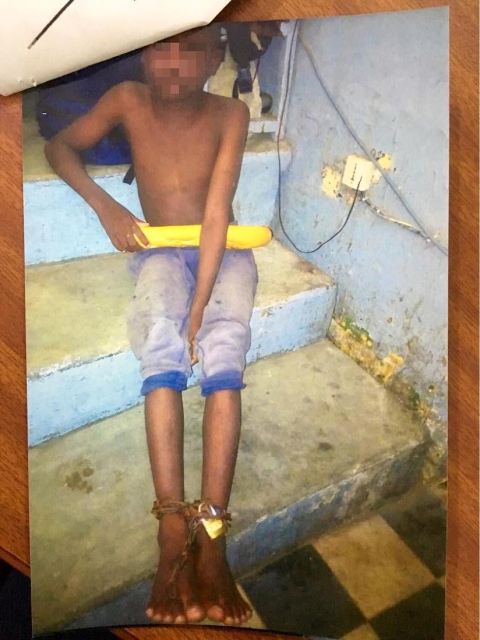 This 8-year-old talibé child ran away from his daara in Saint-Louis, Senegal with chains still attached to his feet in August 2017. Original photo taken August 2017. Published with permission from the High Court of Saint-Louis, Senegal.