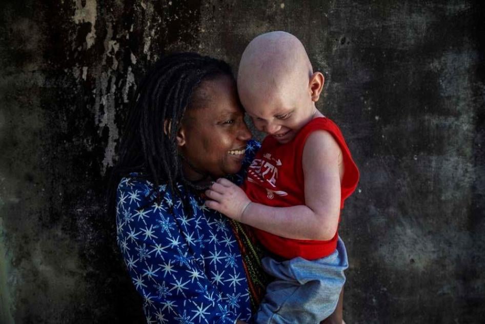 Flavia Pinto, directrice de l’association Azemap qui soutient les personnes atteintes d’albinisme en Mozambique, tient un petit garçon qu’elle est en train d’adopter. Le père de l’enfant a été reconnu coupable de tentative de « vente » de son fils dans ce