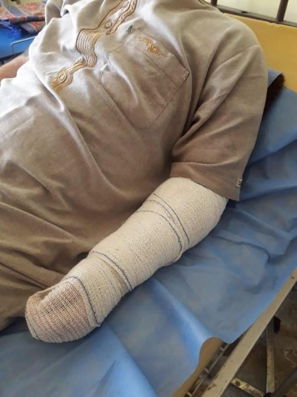 A police officer badly injured the detainee’s left arm while torturing him during an interrogation, leading eventually to an amputation following unsuccessful surgeries. © 2018 Private