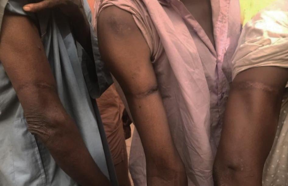 D’anciens détenus montrent les cicatrices de blessures infligées par les forces de sécurité maliennes dans le cadre d’opérations militaires menées à Mondoro, en décembre 2018, au cours desquelles des cordes ou les propres turbans des victimes ont été exce