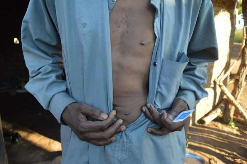 Un survivant de 30 ans de l’attaque du camp Peul près d’Amo, en République centrafricaine, montre les cicatrices laissées par des balles, le 19 avril 2019.