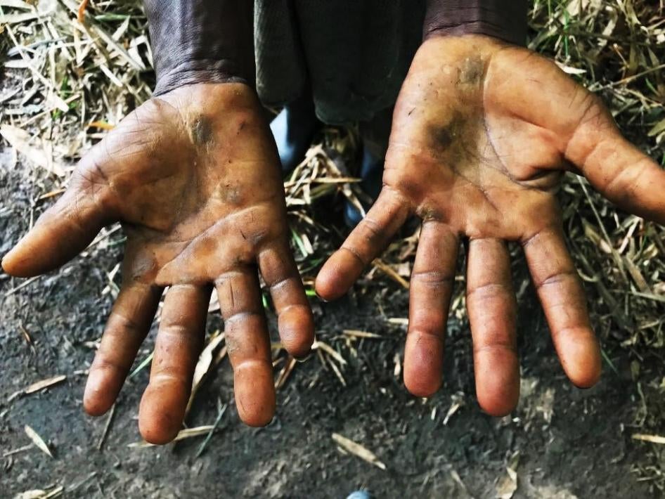 « Je n’ai pas de gants. Cela nous fait mal quand nous ramassons les régimes de fruits », se confie un travailleur qui s’occupe de la cueillette des fruits du palmier à huile pour l’entreprise depuis plus de dix ans. « Parfois, les régimes de fruits tomben