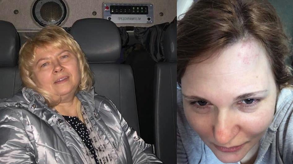 Marina Dubrovina (L) in a police vehicle, and Elena Milashina following separate attacks in Chechnya. 