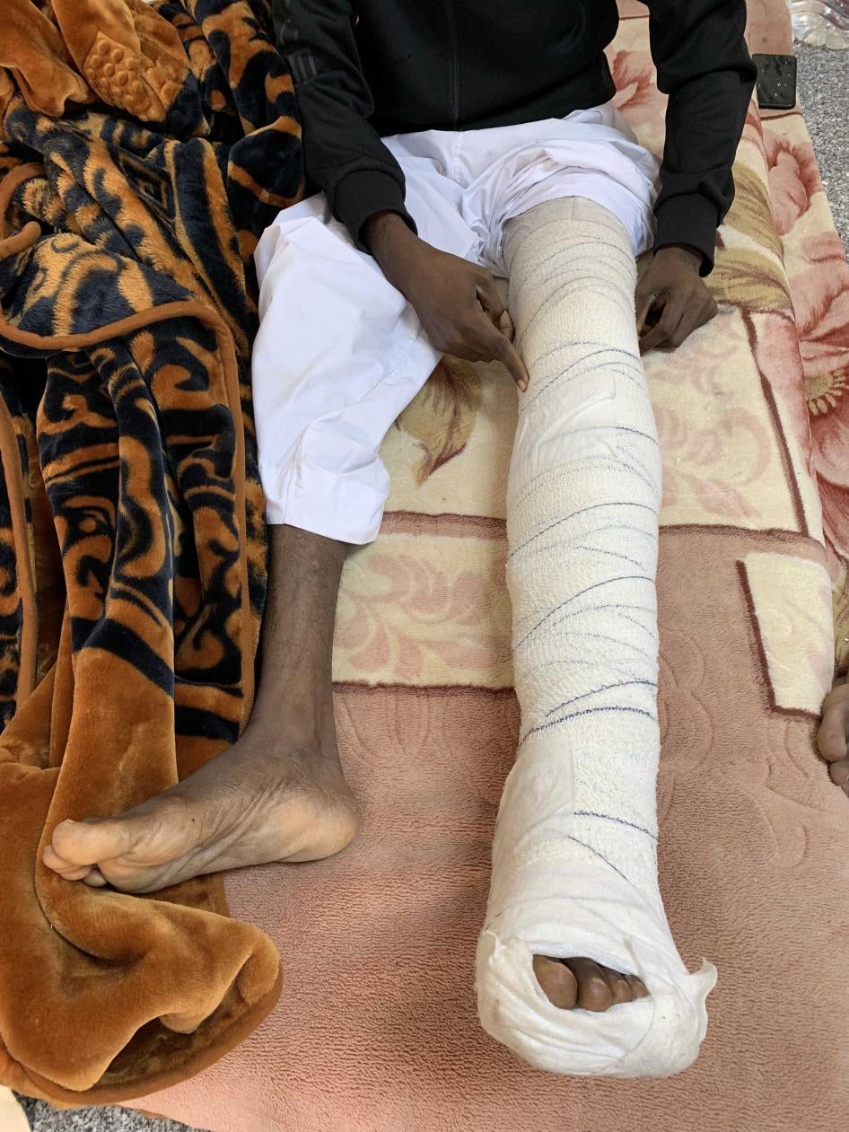 عامل مصنع يتعافى من إصابة في ركبته بعد هجمة بطائرة مسيّرة إماراتية على مصنع بسكويت في أطراف العاصمة الليبية طرابلس قتلت ثمانية مدنيين وجرحت 27 آخرين. ديسمبر/كانون الأول 2019، وادي الربيع، ليبيا.