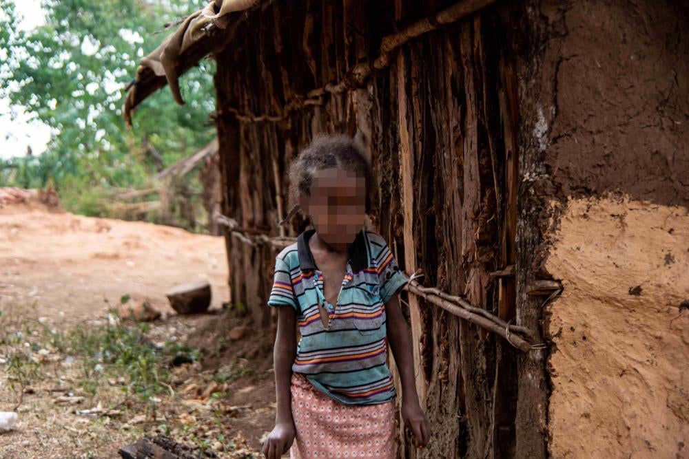 Une fillette de 7 ans présentant un handicap physique, vivant à proximité de la mine d’or de Lega Dembi, dans la région de l’Oromia, en Éthiopie. © 2020 Tom Gardner 