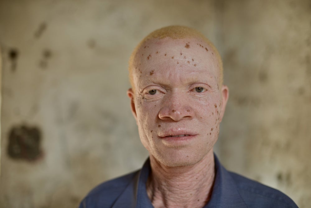 Jawadu London, 40 ans, habite à Mangochi au Malawi. 
