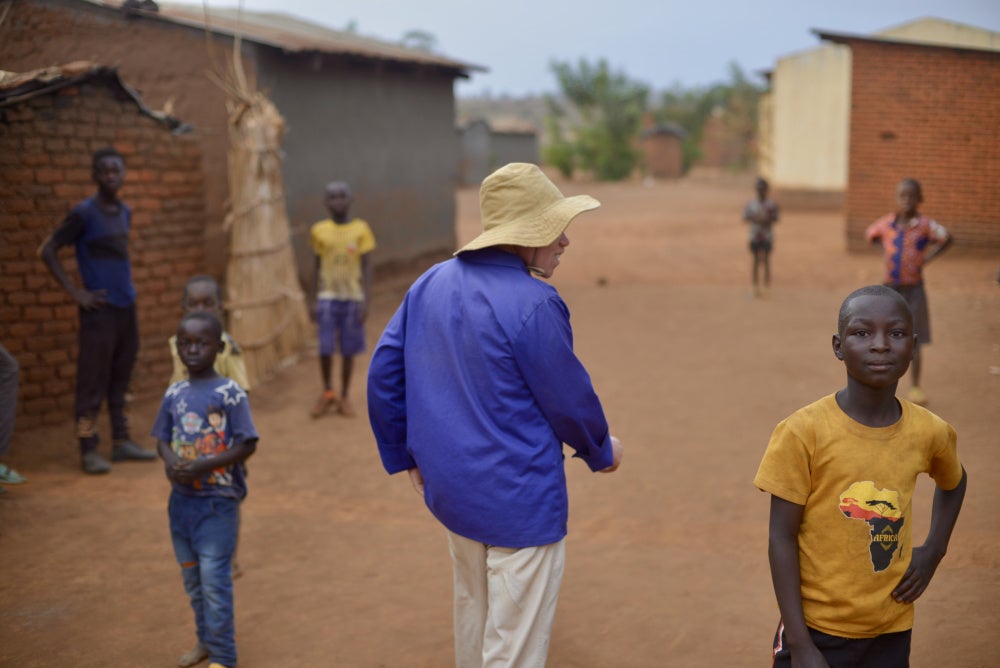 Lazarus K., un homme malawien âgé de 38 ans atteint d’albinisme, à Dowa. 