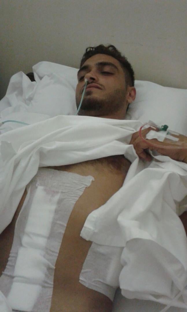جراح المتظاهر أحمد بعد إطلاق النار عليه من قبل قوى الأمن يوم 22 أغسطس/آب 2015.