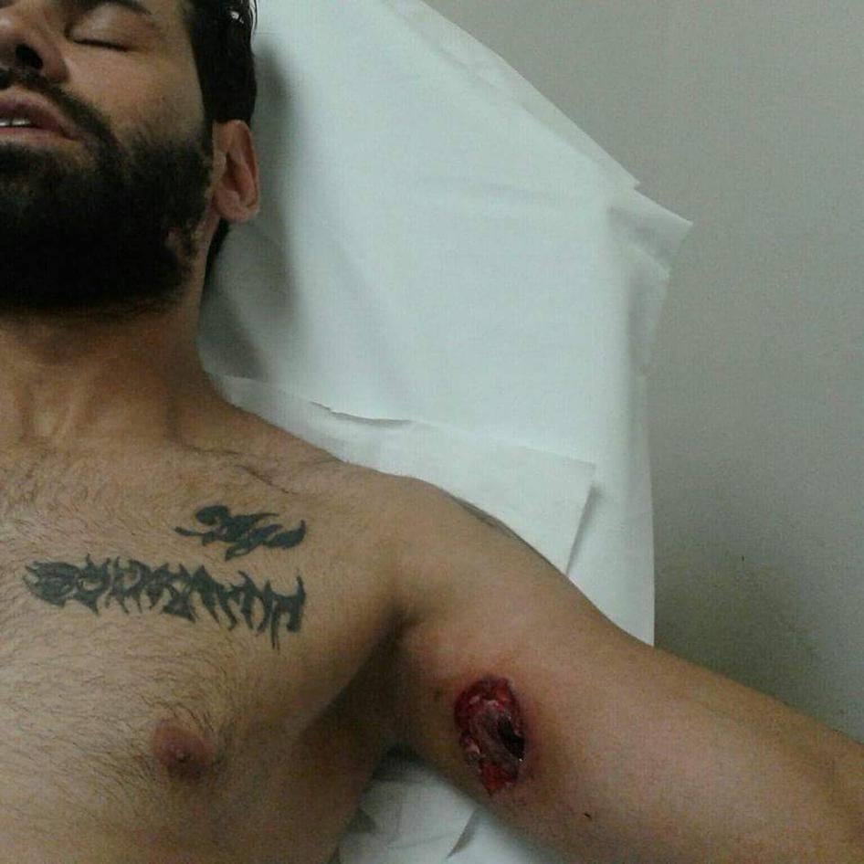 Protester Abdullah’s wounds after he was shot by a rubber bullet by Lebanese security forces on August 22, 2015.