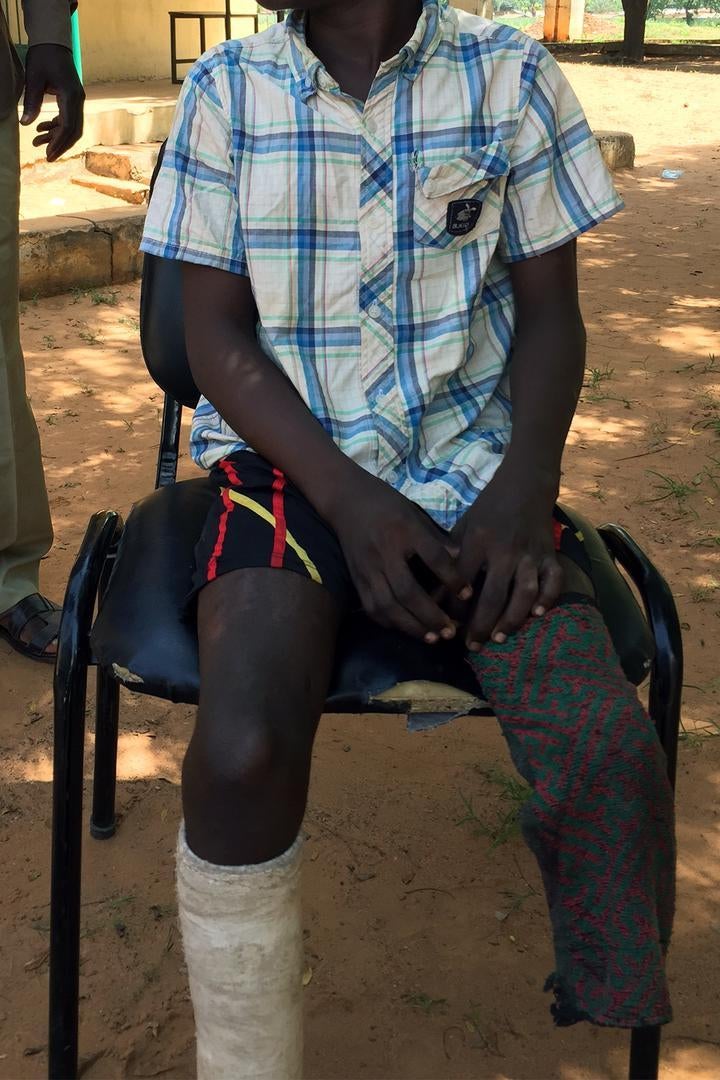 ‘Hassan’ a student injured by a suicide bomber at the Government Science and Technical College, Potiskum, Yobe state, in November 2014. He was unable to return to school for more than a year due to the serious injuries to his legs. Twenty-six other studen