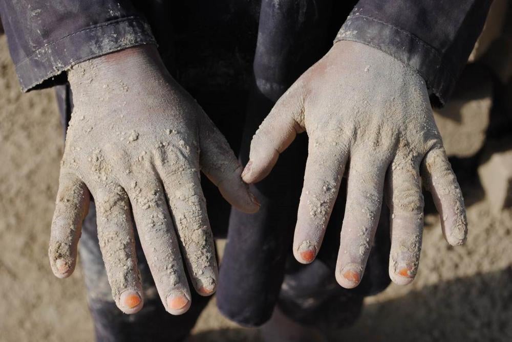 Helal, 10, works as a brick maker at a brick kiln outside Kabul. He told Human Rights Watch that the brick mold is heavy and his hands hurt working with wet clay. Helal doesn’t go to school because he has to work.  