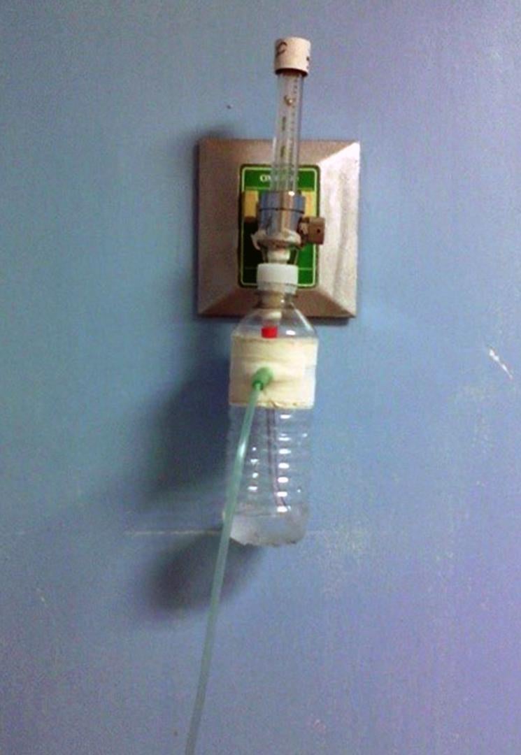In the absence of supplies, doctors at the neonatology ward of the University Hospital Pedro E Carrillo in Valera, Trujillo State, are improvising humidifiers like this one, made of a plastic water bottle, July 2016.