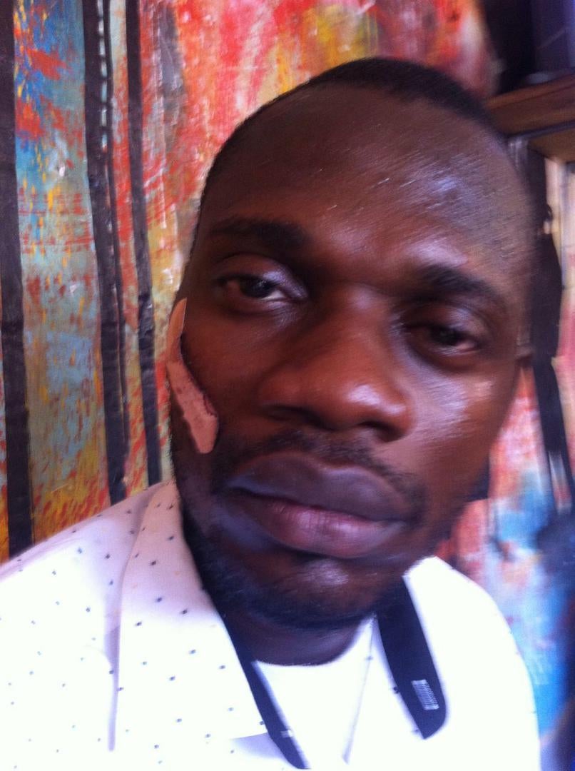 Fabrice Bakalufu, member of the opposition party Union of Democracy and Social Progress (UPDS), was beaten by police on November 18. Two of his colleagues were arrested and remain in detention.