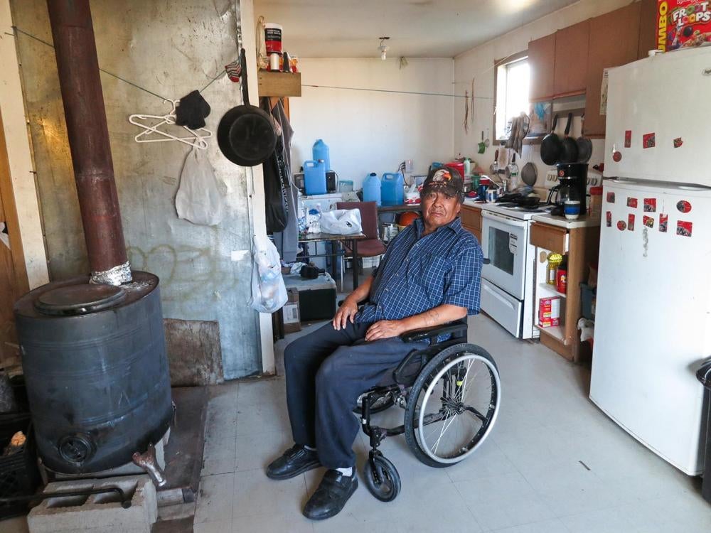 Walter Sakanee, an elder living in Neskantaga First Nation, has had difficulty fighting infections in his legs. He relies on his family members to collect safe drinking water for him in blue plastic jugs from a reverse osmosis machine located at the commu