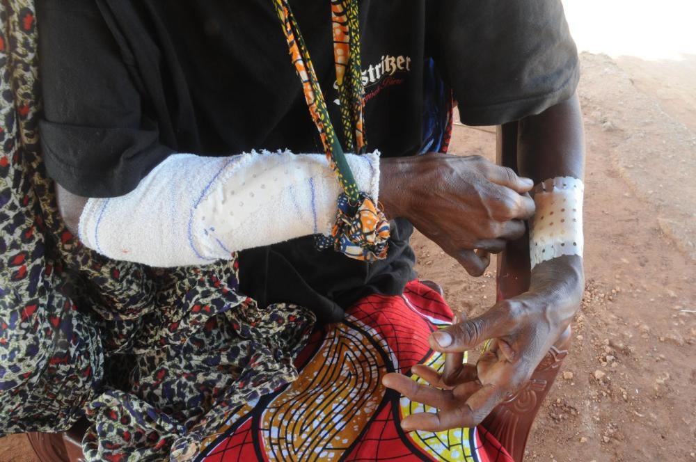 Cette femme âgee de 40 ans est la seule survivante connue d'une attaque contre neuf civils peuls près du village de Golaga, en République centrafricaine, le 26 novembre 2016.