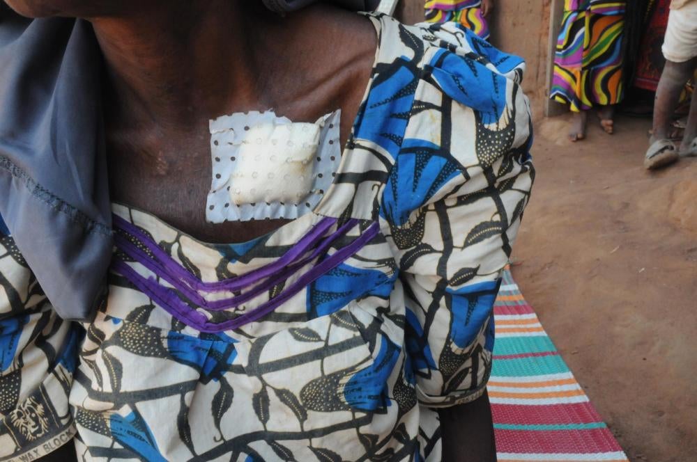 Des combattants du FPRC ont tiré dans le dos de cette femme peule de 66 ans alors qu'elle tentait de protéger son fils qu'ils ont abattu par balles, à Gobolo (République centrafricaine) le 21 novembre 2016.