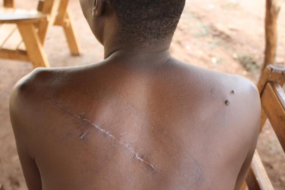 Des combattants du Mouvement patriotique pour la Centrafrique (MPC) et des civils musulmans armés ont essayé de tuer cet homme, prénommé « Emmanuel », à coups de machette à Batangafo, dans la province d'Ouham en République centrafricaine, le 29 juillet 20
