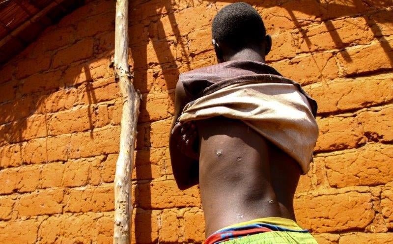 Un garçon de 15 ans, qui a survécu à une attaque de janvier 2017 menée par l’Union pour la Paix en Centrafrique (UPC) contre son village, Mourouba, en République centrafricaine. Ce jour-là, des combattants peuls de l’UPC ont tué son père et deux de ses fr