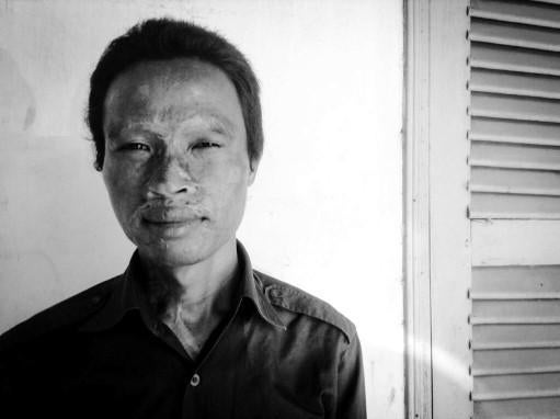 Deb Da, un jeune homme cambodgien dont la mère a été tuée lors d’une attaque à l’acide en 1997 et qui lui-même a été grièvement blessé lors de cette attaque commise quand il était enfant, photographié à Phnom Penh en novembre 2014.