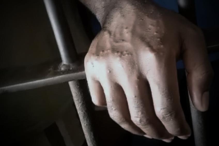 Asylum Seekers Abused in the US and Deported to Harm in Cameroon - Vimarsana News