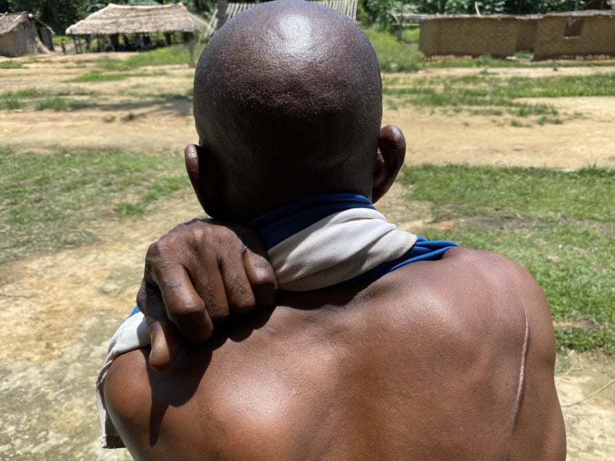 DR Congo: Neglected Massacre of Indigenous Group - Vimarsana News