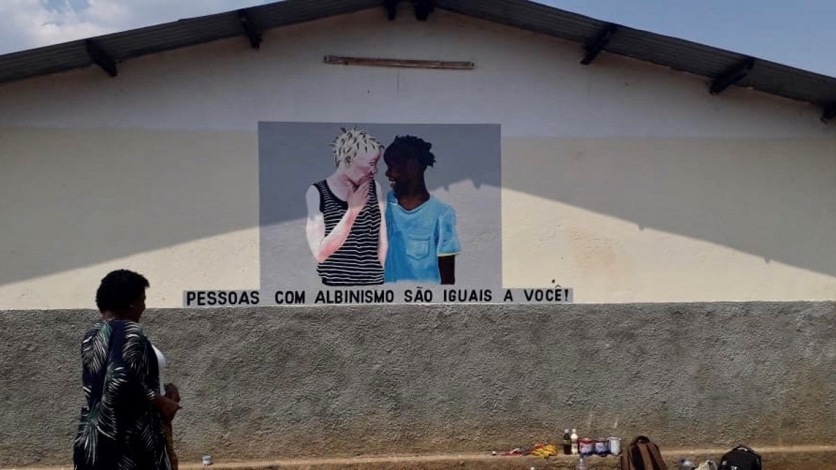 Using Art to Fight Discrimination Against People with Albinism | Human ...