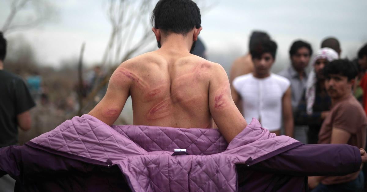 Forced Striped Down Xxx - Greece: Violence Against Asylum Seekers at Border | Human Rights Watch