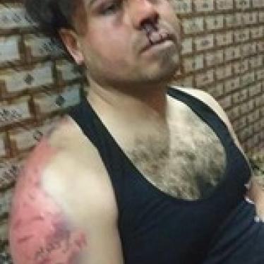 Ali Naseer Alawy, after armed masked men beat him and used an acid mixture to try to remove a tattoo on his arm.