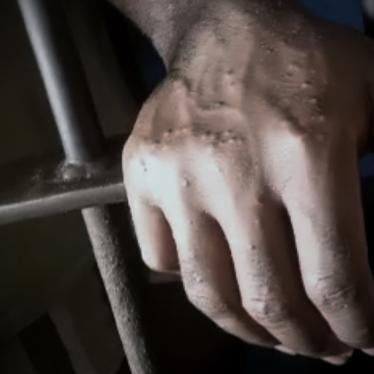 A hand reaches through bars