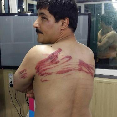 Visible injuries suffered by a protester in Baghdad, Iraq after being detained and beaten with cables by unidentified attackers in civilian clothes on September 18, 2015. Photo taken September 20, 2015. 