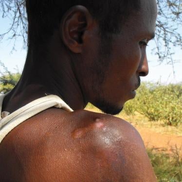 Maash Hussein Abikar shows scars left by Kenyan soldiers when he was beaten with a gun butt during a round-up of ethnic Somalis in Wajir in December 2011. He also lost two teeth and now has blurry vision in one eye as a result of the beating.