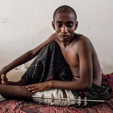 Ethiopian migrant, 19, at a local medical facility in Haradh. He said he was tortured for a month and shot in the leg by traffickers trying to extort money from family members abroad, May 2013.