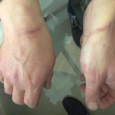 Украина: Нарушения, связанные с задержаниями в контексте вооруженного конфликта