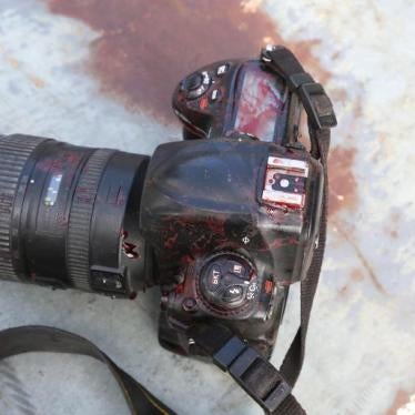 The blood stained camera of a photojournalist is seen after a secondary explosion in front of Dayah hotel in Somalia's capital Mogadishu, January 25, 2017.