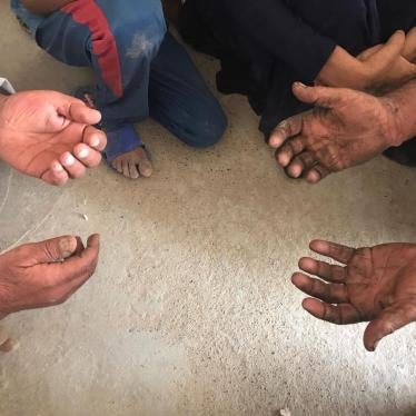 Two elderly men from Sayhat Othman village show researchers the blisters on their wrists caused by handcuffs.
