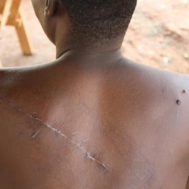 MPC fighters and armed Muslim civilians tried to kill “Emmanuel” with machetes in Batangafo, Ouham province, Central African Republic, on July 29, 2017. 