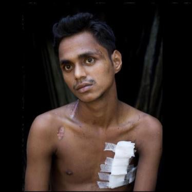 Muhamedul Hassan, un jeune homme rohingya âgé de 18 ans, originaire du village de Maung Nu en Birmanie, qui a été blessé par des coups de feu tirés par des soldats birmans.