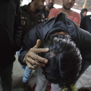 A migrant who claims he was beaten by Croatian police while attempting to cross the border to Croatia shows his injury at a factory hall turned migrants facility in Bihac, Bosnia-Herzegovina, Wednesday, March 13, 2019.