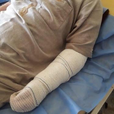 A police officer badly injured the detainee’s left arm while torturing him during an interrogation, leading eventually to an amputation following unsuccessful surgeries. © 2018 Private