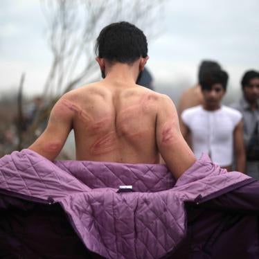 An asylum seeker in northern Turkey at the Greek border on March 6 shows injuries he says Greek security forces inflicted after he had crossed the Evros River into Greece. Photo by Turkish Radio and Television Corporation/Handout/Anadolu Agency.